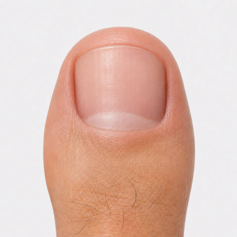 Uñas del pie con aspecto amarillento